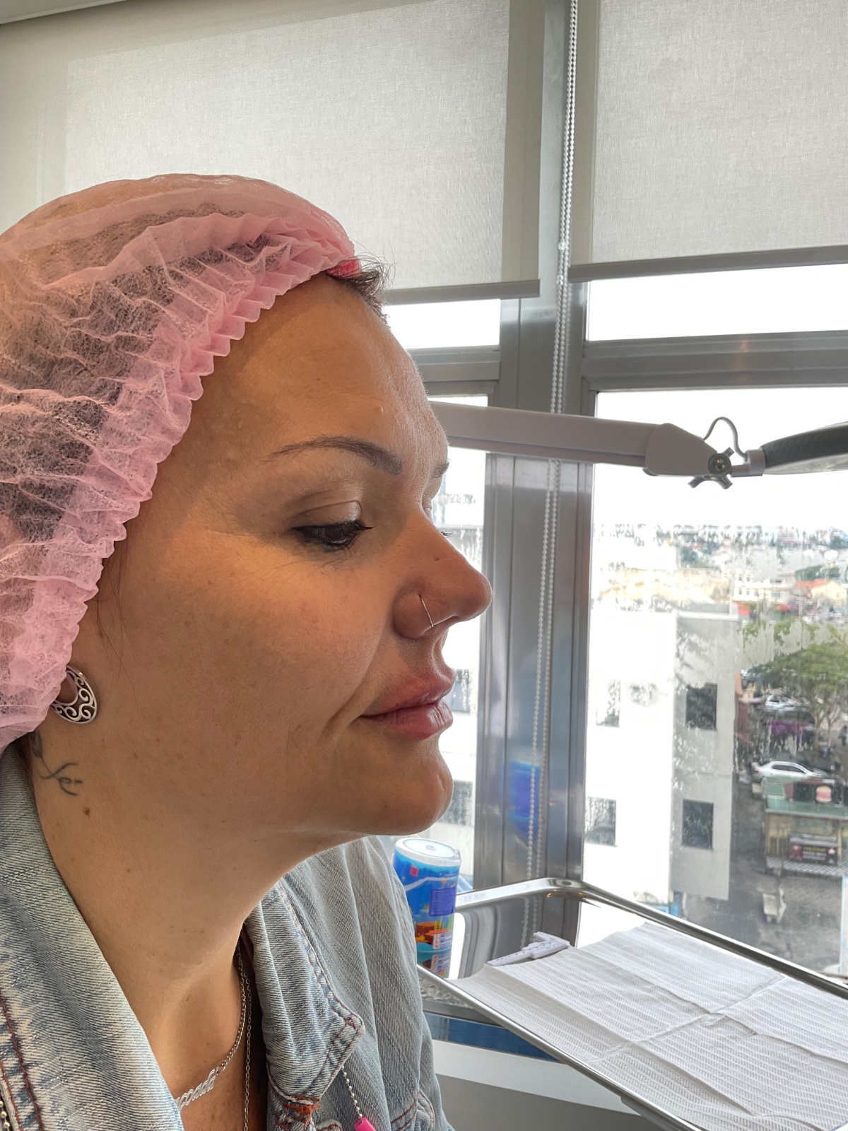 Depois do tratamento