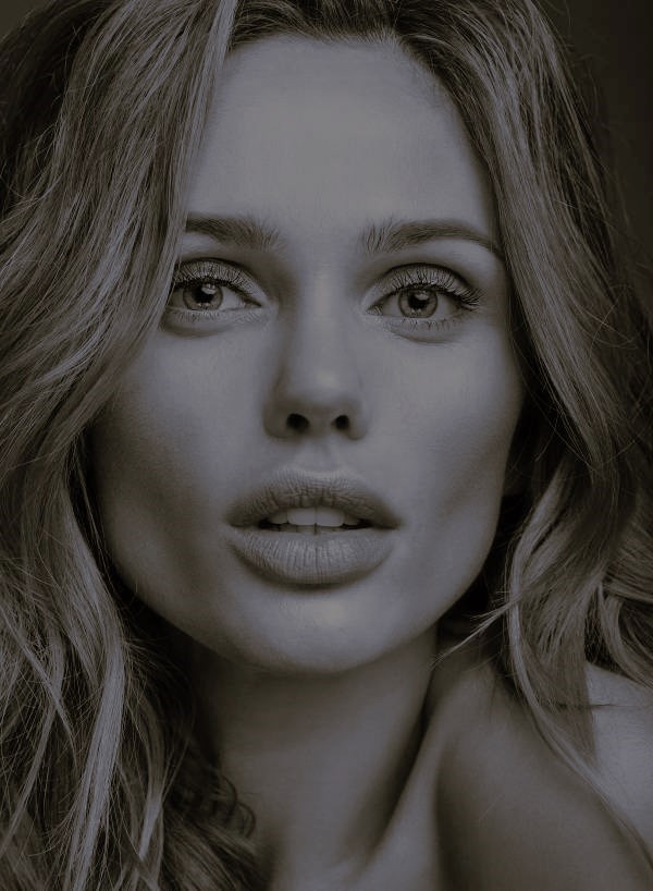 Harmonização Facial